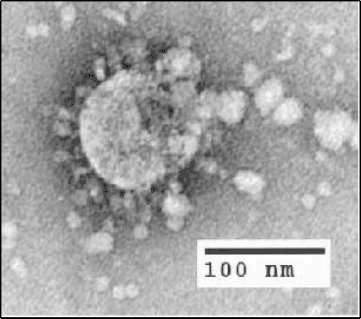 صورة ميكروسكوبية لفيروس كورونا المرتبط بالمتلازمة التنفسية الحادة الشديدة النوع 1 - المصدر ويكيبيديا